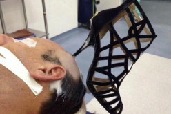 كعب حذاء في رأس رجل يثير الجدل على مواقع التواصل الإجتماعي