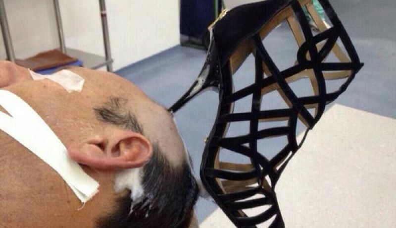 كعب حذاء في رأس رجل يثير الجدل على مواقع التواصل الإجتماعي