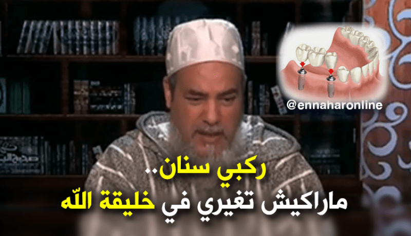 الشيخ شمس الدين: تركيب أسنان إصطناعية لا تغيّر من خلق الله