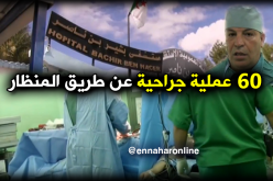 60 عملية جراحية لاستئصال الأورام عن طريق المنظار ببسكرة