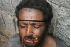إلقاء القبض على مصّاص دماء في اليمن