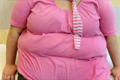 30 بالمئة من النساء الجزائريات يعانين السمنة