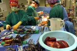 تفكيك شبكة دولية لتجارة الأعضاء البشرية يتزعمها طبيب