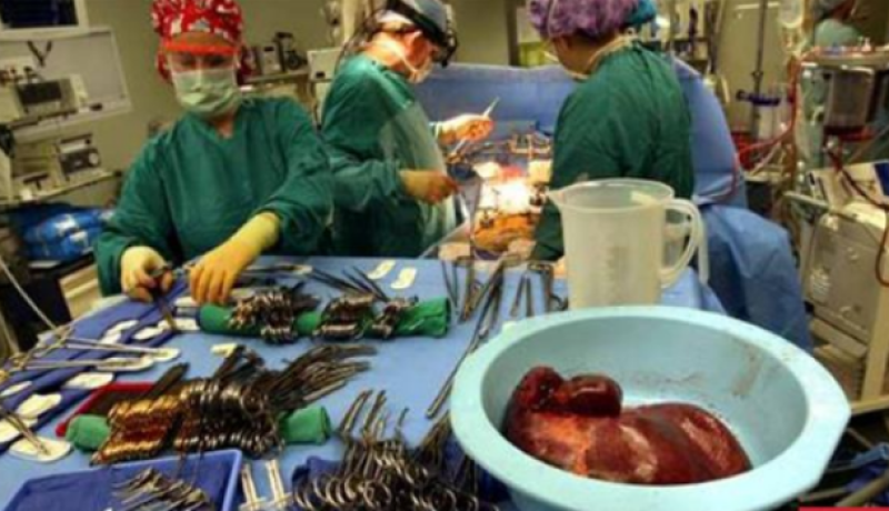 تفكيك شبكة دولية لتجارة الأعضاء البشرية يتزعمها طبيب