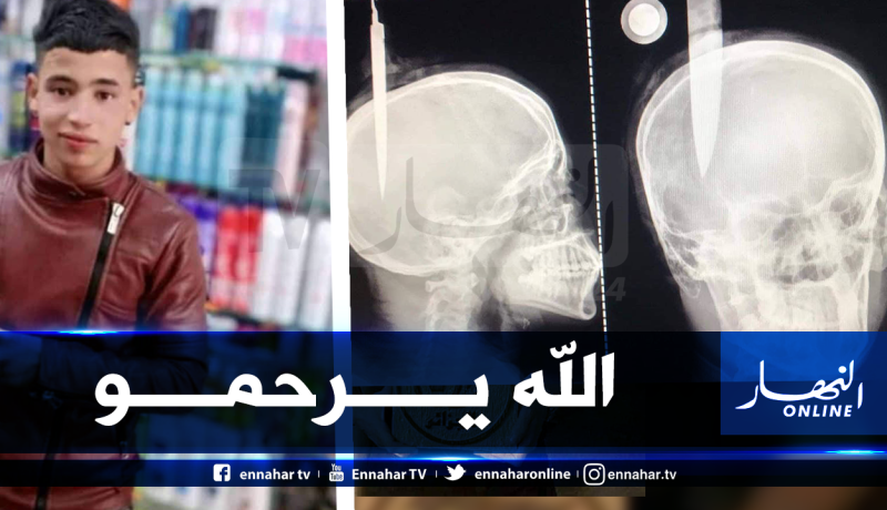 شاب يلفظ أنفاسه الأخيرة متأثرا بطعنة في الرأس بباتنة