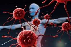 تقنية جديدة توقف انتشار الورم السرطاني