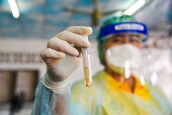 مختبر ووهان: لدينا عينات فيروسات تاجية تنحدر من الخفافيش!