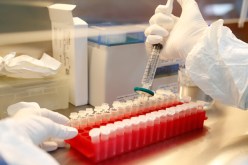 روسيا: إنتاج اللقاح يبدأ في سبتمبر و20 دولة قدمت طلبات لاقتنائه