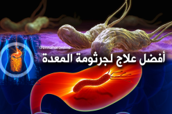 جرثومة المعدة أسبابها وعلاجها طبيعيا