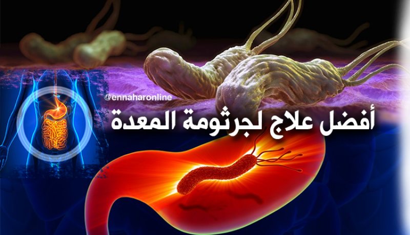 جرثومة المعدة أسبابها وعلاجها طبيعيا