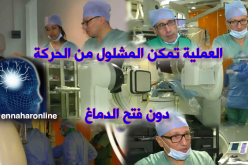 أول عملية بالجزائر لعلاج العاهات بأوعية المخ دون فتح الدماغ