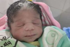 مصر.. ولادة طفلة بشعر أبيض والأطباء يُحددون السبب