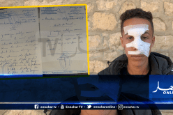 تلميذ يتعرض لإعتداء خطير من طرف زميله بثانوية في تبسه ويتم تركه دون إسعاف!