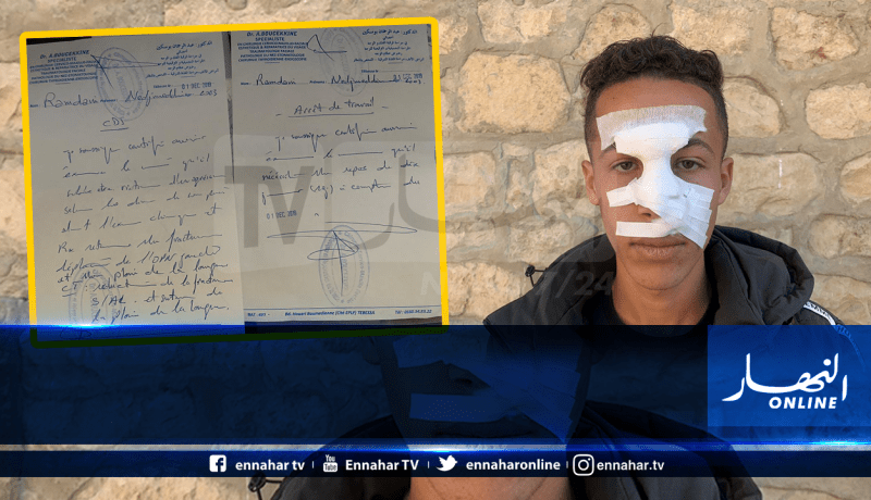 تلميذ يتعرض لإعتداء خطير من طرف زميله بثانوية في تبسه ويتم تركه دون إسعاف!