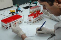 إعتماد تحليل اللعاب للكشف عن السيدا والإلتهاب الكبدي لأول مرة بالجزائر