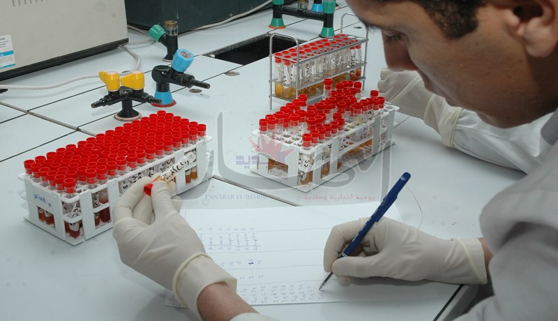 إعتماد تحليل اللعاب للكشف عن السيدا والإلتهاب الكبدي لأول مرة بالجزائر