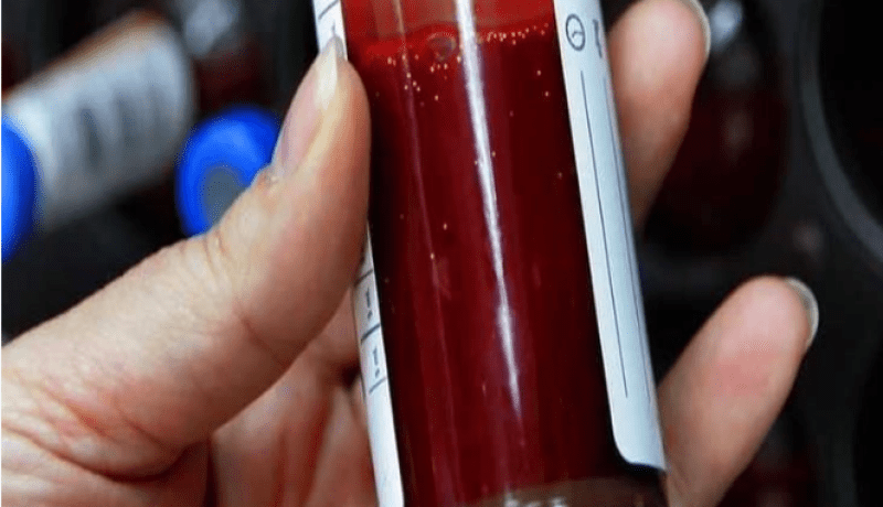 سجن أم تمص دم طفلها منذ 5 سنوات