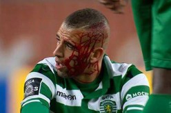 بالفيديو إسلام سليماني يتعرض لنزيف حاد بعد تدخل عنيف