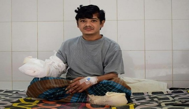 بالفيديو.. 16 عملية جراحية للرجل الشجرة لإستعادة حياته الطبيعية