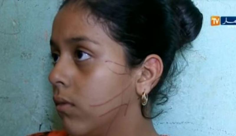 فيديو.. تشويه وجه تلميذة بالسكين في تيارت من قبل زميلتها