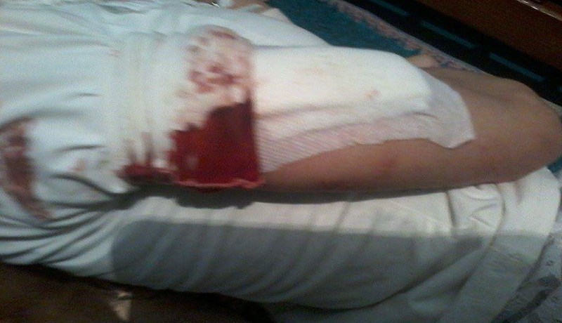 سحرة يحوّلون جسد فتاة معاقة إلى مصنع للإبر