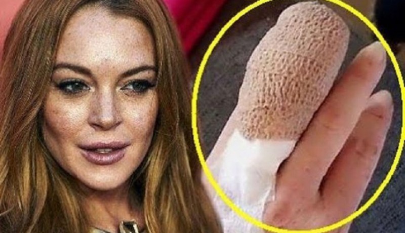 الممثلة الأمريكية ليندسي لوهان تفقد أصبعها وأصدقاؤها يعثرون عليه