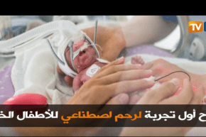 نجاح أول تجربة لرحم اصطناعي للأطفال الخدج