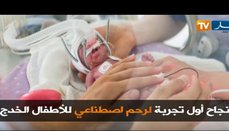 نجاح أول تجربة لرحم اصطناعي للأطفال الخدج