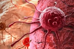 قريبا..وداعا لأورام السرطان