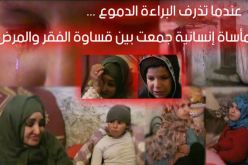 عندما تذرف البراءة الدموع..مأساة إنسانية جمعت بين قساوة الفقر والمرض