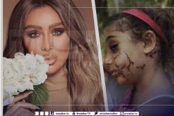 مايا دياب تطلق مبادرة لترميم وجوه الأطفال ضحايا إنفجار بيروت