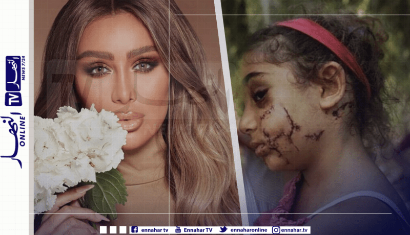 مايا دياب تطلق مبادرة لترميم وجوه الأطفال ضحايا إنفجار بيروت