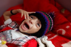 اليونسيف تحذّر من مخاطر تفشي مرض الكوليرا في اليمن بعد رصد بعض الحالات
