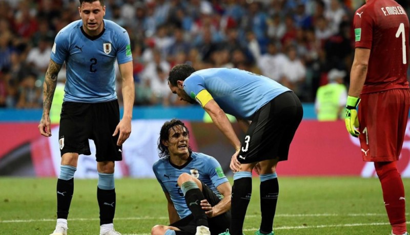 شكوك حول مشاركة كافاني أمام فرنسا