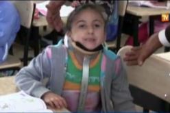 بالفيديو.. الطفلة لميس تعيش إعاقة نادرة  تحلم بعملية جراحية