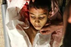 فتحت بطن جريح لمعالجته فخرج منه دخان يفوح براحة الثوم