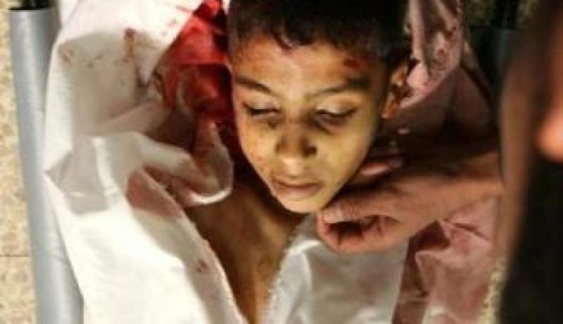 فتحت بطن جريح لمعالجته فخرج منه دخان يفوح براحة الثوم