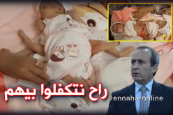 وزارة الصحة تتكفل بالتوأم السيامي بميلة