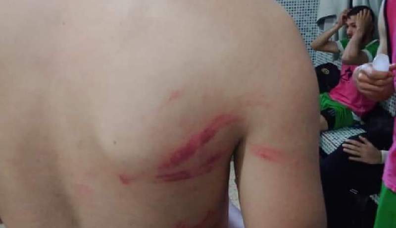 بالصور.. أنصار “نصر السانيا” يعتدون على لاعبي ترجي مستغانم بوهران