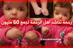 رحمة تناشد المحسنين لإجراء عملية جراحية