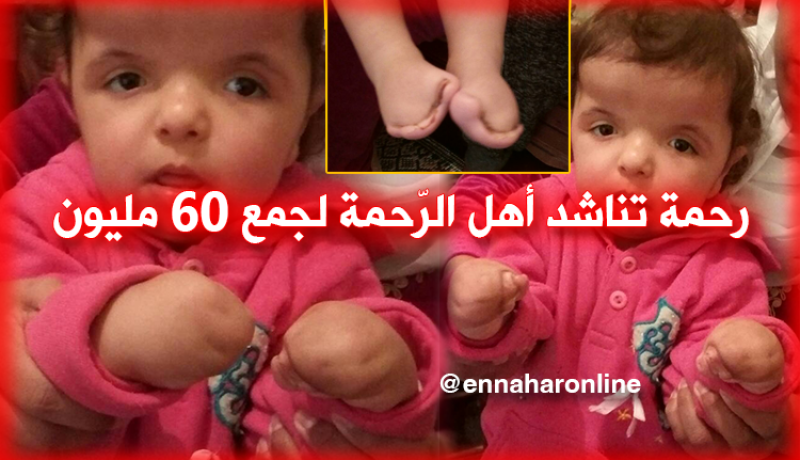 رحمة تناشد المحسنين لإجراء عملية جراحية