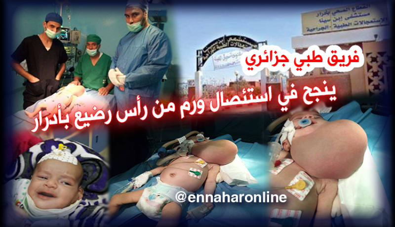 مستشفى إبن سينا بأدرار يستأصل ورم من رضيع بنجاح