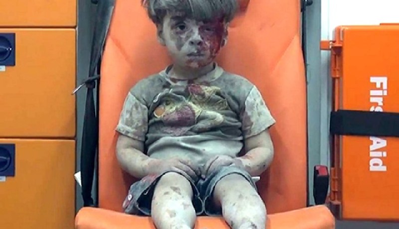 وفاة شقيق الطفل عمران الذي صدمت صوره العالم متأثرا بجراحه