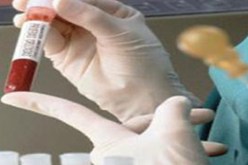 تحليل دم بسيط يساعد على تشخيص نوبات الاكتئاب