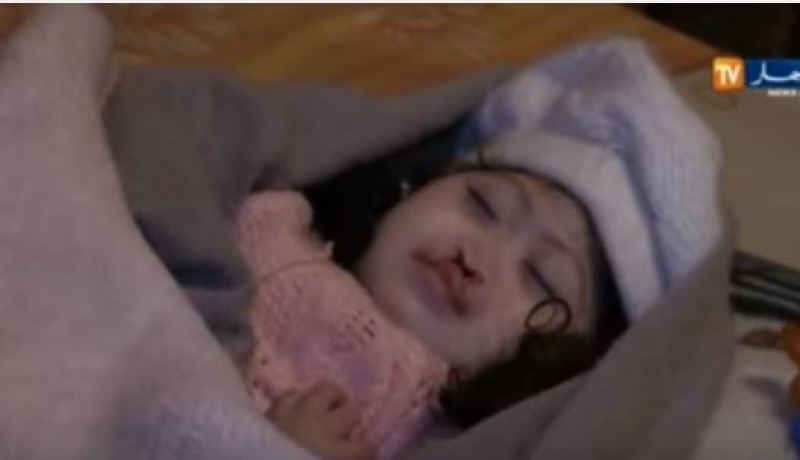 بالفيديو وزارة التضامن تتكفل بالرضيعة زينب التي تعاني من تشوه خلقي