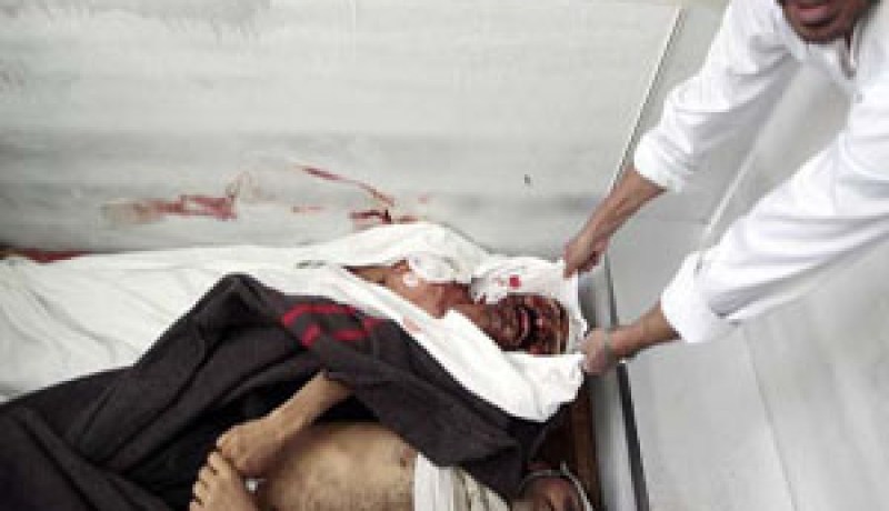 37 قتيلا في معارك خلال الليل بين القوات اليمنية وانصار ال الاحمر في صنعاء