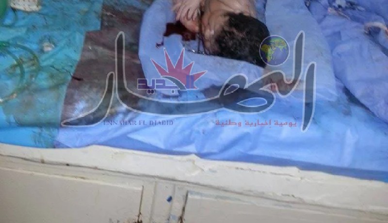 فضيحة مستشفى قسنطينة يمتد صداها إلى الإعلام العالمي