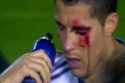 مورينيو يكشف أن رونالدو فقد نظره بين الشوطين