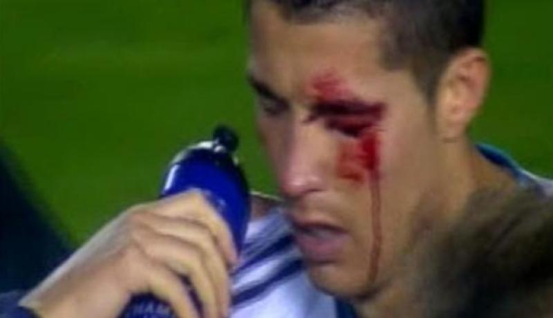 مورينيو يكشف أن رونالدو فقد نظره بين الشوطين