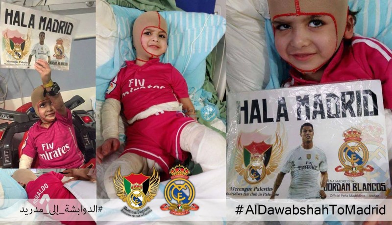 ريال مدريد سيستضيف أحمد دوابشة الناجي الوحيد بعد أن أحرق اسرائيليون منزل عائلته